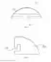 Fig. 06 - Traction bracket, orthodontic system and orthodontic method therefor