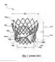 Fig. 02 - Heart valve prosthesis and separate support flange for attachment thereto