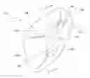 Fig. 01 - Method for manufacturing a low-profile intercranial device and the low-profile intercranial device manufactured thereby