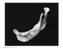 Fig. 01 - Three-dimensionally printed tissue engineering scaffolds for tissue regeneration