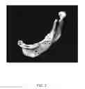 Fig. 03 - Three-dimensionally printed tissue engineering scaffolds for tissue regeneration