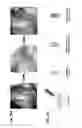 Fig. 19 - Three-dimensionally printed tissue engineering scaffolds for tissue regeneration