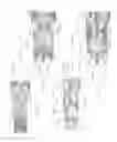 Fig. 08 - Expandable intervertebral implant