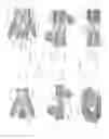 Fig. 09 - Expandable intervertebral implant