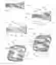 Fig. 12 - Expandable intervertebral implant