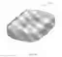 Fig. 13 - Expandable intervertebral implant