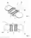Fig. 07 - Intervertebral prosthesis or disk prosthesis