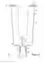 Fig. 03 - Prosthesis casting device