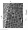 Fig. 02 - Corrugated microporous tissue interface for improved performance and infection resistance of vascular grafts and other implantable devices