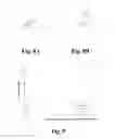 Fig. 09 - LUMINAL IMPLANT FOR THE CORRECTION OF OCCLUSIONS