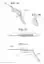 Fig. 02 - Tympanic membrane pressure equalization tube delivery system
