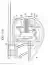 Fig. 11 - Tympanic membrane pressure equalization tube delivery system