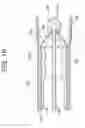 Fig. 12 - Tympanic membrane pressure equalization tube delivery system