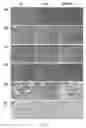 Fig. 05 - Use of composition for manufacturing anti-fatigue probiotic composition to improve exercise performance