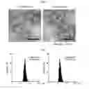 Fig. 02 - Method of treating an inflammatory disease using lactic acid bacteria-derived extracellular vesicles