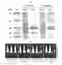Fig. 03 - Method of treating an inflammatory disease using lactic acid bacteria-derived extracellular vesicles