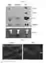 Fig. 04 - Method of treating an inflammatory disease using lactic acid bacteria-derived extracellular vesicles