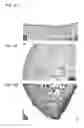 Fig. 09 - Bioengineered allogeneic blood vessel