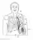 Fig. 01 - Blood pump assembly and method of use thereof