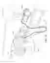 Fig. 02 - Humidifier for a respiratory therapy device