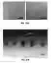 Fig. 25 - PROTRUDING MICROSTRUCTURE FOR TRANSDERMAL DELIVERY