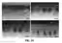 Fig. 26 - PROTRUDING MICROSTRUCTURE FOR TRANSDERMAL DELIVERY