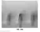 Fig. 32 - PROTRUDING MICROSTRUCTURE FOR TRANSDERMAL DELIVERY
