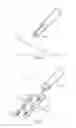 Fig. 08 - SYSTEMS AND METHODS FOR REVERSIBLE NERVE BLOCK TO  RELIEVE DISEASE SYMPTOMS