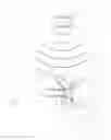 Fig. 09 - SYSTEMS AND METHODS FOR REVERSIBLE NERVE BLOCK TO  RELIEVE DISEASE SYMPTOMS