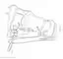 Fig. 12 - SYSTEMS AND METHODS FOR REVERSIBLE NERVE BLOCK TO  RELIEVE DISEASE SYMPTOMS