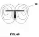 Fig. 09 - Skull implanted magnet assembly for brain stimulation