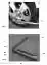 Fig. 05 - CYLINDER FOR REMOVAL, STORAGE, AND ATTACHMENT OF LUG NUTS