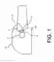 Fig. 02 - Control arm mount