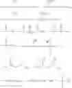 Fig. 16 - Fabric enhancer composition