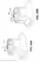 Fig. 35 - Systems and methods for medical device control