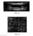 Fig. 11 - Development of spinal cord on a microfluidic chip