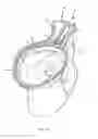 Fig. 11 - Self-cleaning toilet assembly and system