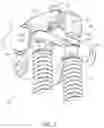 Fig. 07 - Removable valve bridges and valve actuation systems including the same