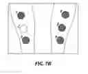 Fig. 09 - DEVICE AND METHOD FOR IN VITRO EVALUATION OF CLEANSERS