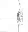 Fig. 01 - Head-mounted display