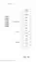 Fig. 06 - Message pattern detection and processing suspension