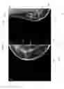 Fig. 07 - CUSTOMIZING ANNOTATIONS ON MEDICAL IMAGES
