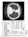 Fig. 22 - CUSTOMIZING ANNOTATIONS ON MEDICAL IMAGES