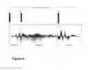 Fig. 08 - Method for audio sample playback using mapped impulse responses