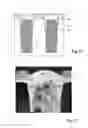 Fig. 09 - VERTICAL TRANSFER GATE TRANSISTOR AND ACTIVE CMOS IMAGE SENSOR PIXEL INCLUDING A VERTICAL TRANSFER GATE TRANSISTOR