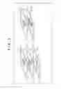 Fig. 02 - Image sensor, processing method, and electronic device for suppressing deterioration in image quality