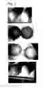 Fig. 03 - Processed citrus fruit item having reduced bitterness