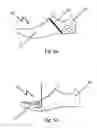 Fig. 05 - SHOE ADAPTED TO THE SHAPE OF THE FOOT