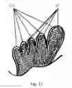 Fig. 12 - SHOE ADAPTED TO THE SHAPE OF THE FOOT