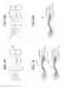Fig. 09 - SPINE SUPPORT INSERT FOR ADJUSTABLE CUSHION DEVICE